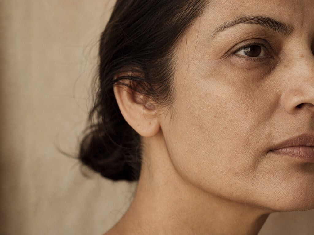 Close crop of a woman's cheek, bare and matte with dry, papery skin